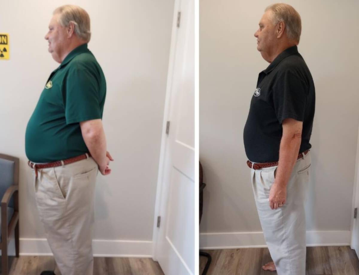 Junior lost 47 pounds in 6 months!
